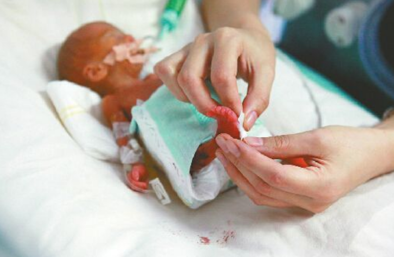 2015年山东女子产下5胞胎,"最小"的"鸡蛋"大,如今孩子们都健康吗?