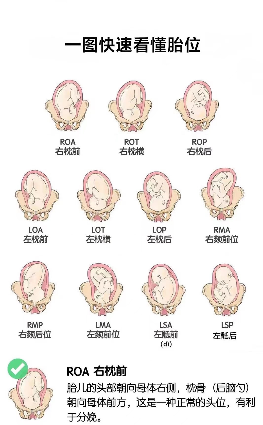 护考必考考点  看图速记考点