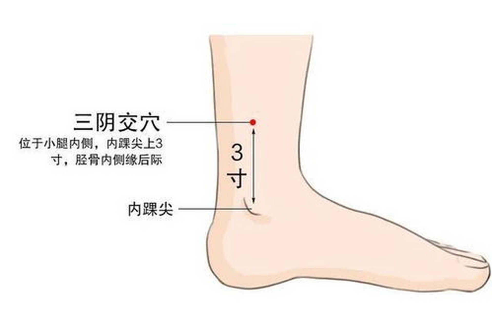 小腿内侧疼痛部位图解图片