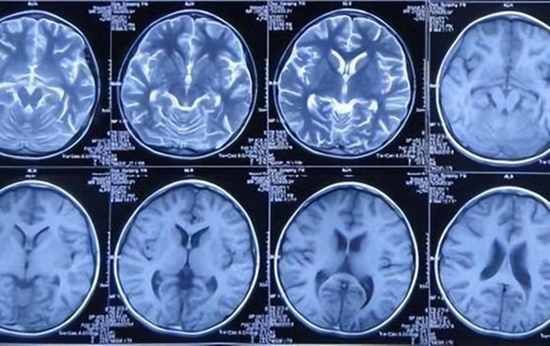 回顾:男子无偿献血13年,患病急需50万,爱心人士纷纷捐款