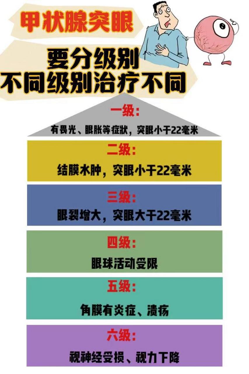 甲亢突眼症可分为6级 1一级:有畏光,眼胀等症状,突眼小于22毫米 2