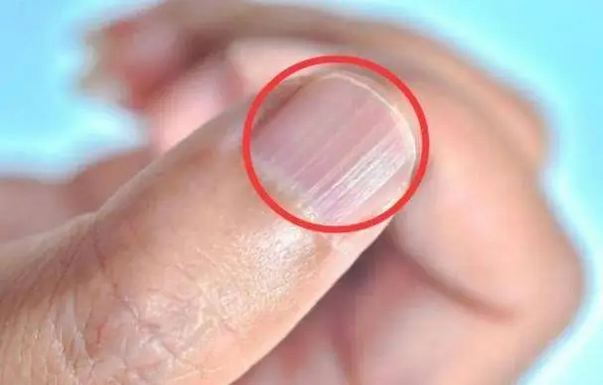 指甲出现这四种状态,警惕肝脏出现问题!