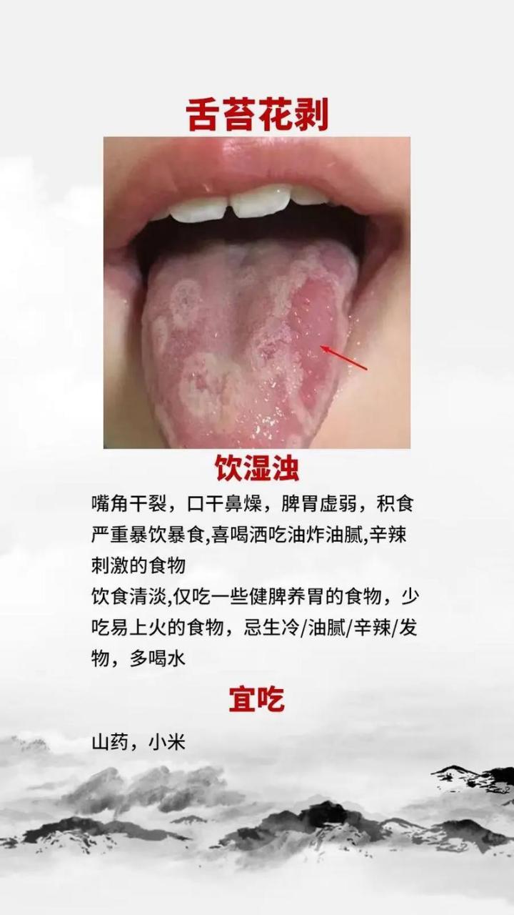 中医教你看舌象#健康# #舌诊# #舌象