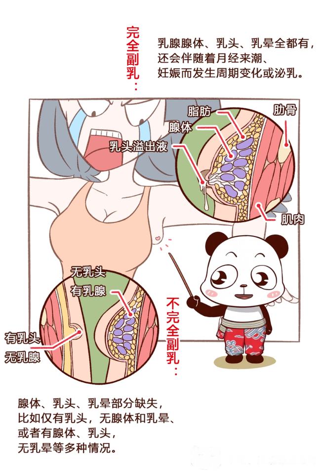 副乳手术一般多少钱图片