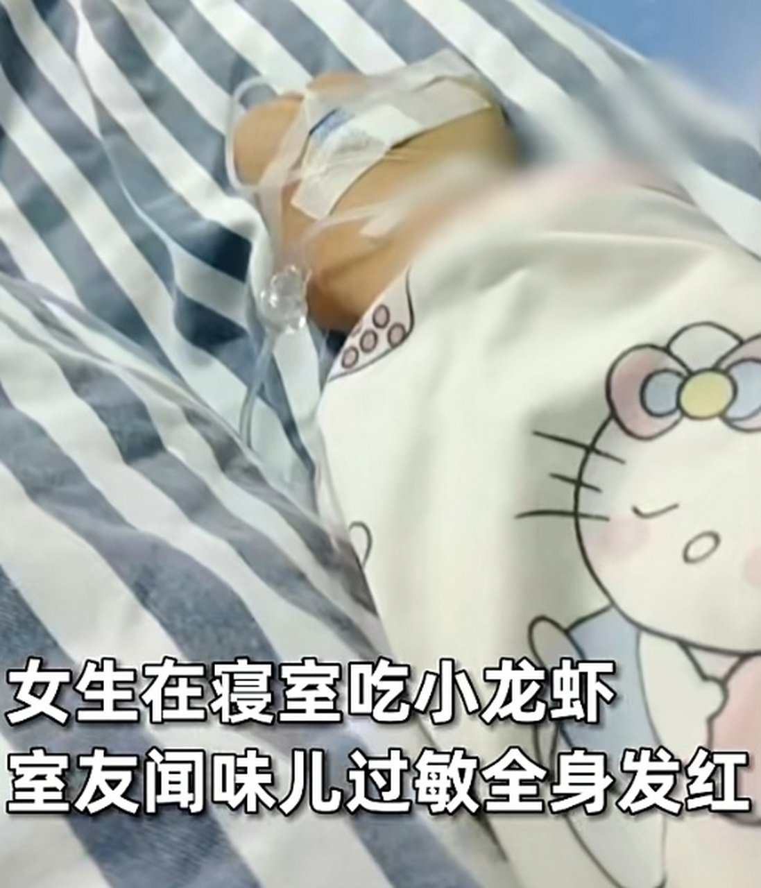 女生闻到小龙虾气味过敏全身发红?