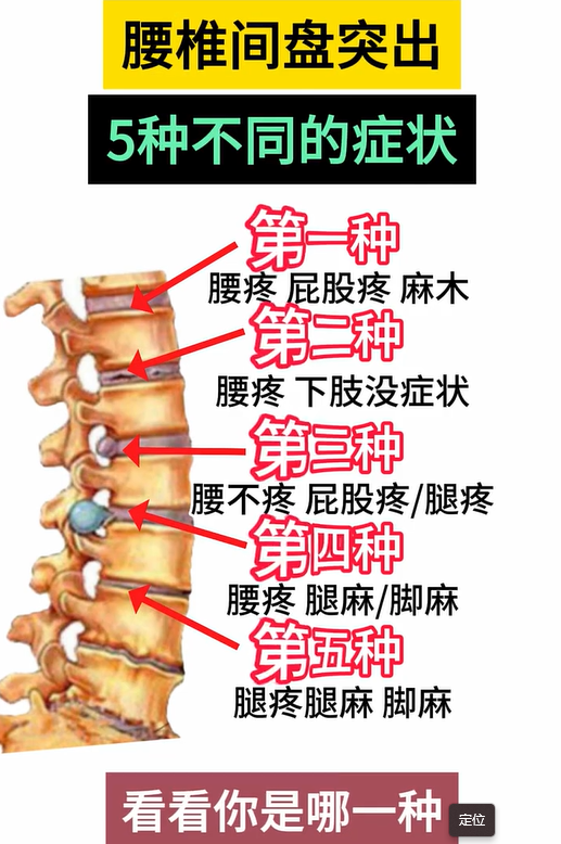 腰椎一至五节图片大全图片