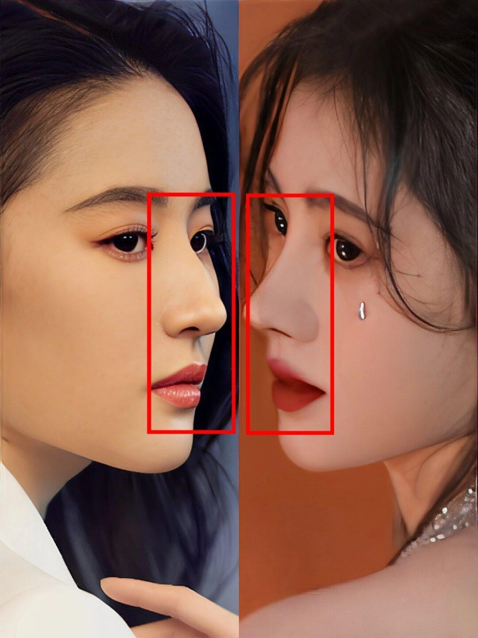 刘亦菲是整容医院的模版