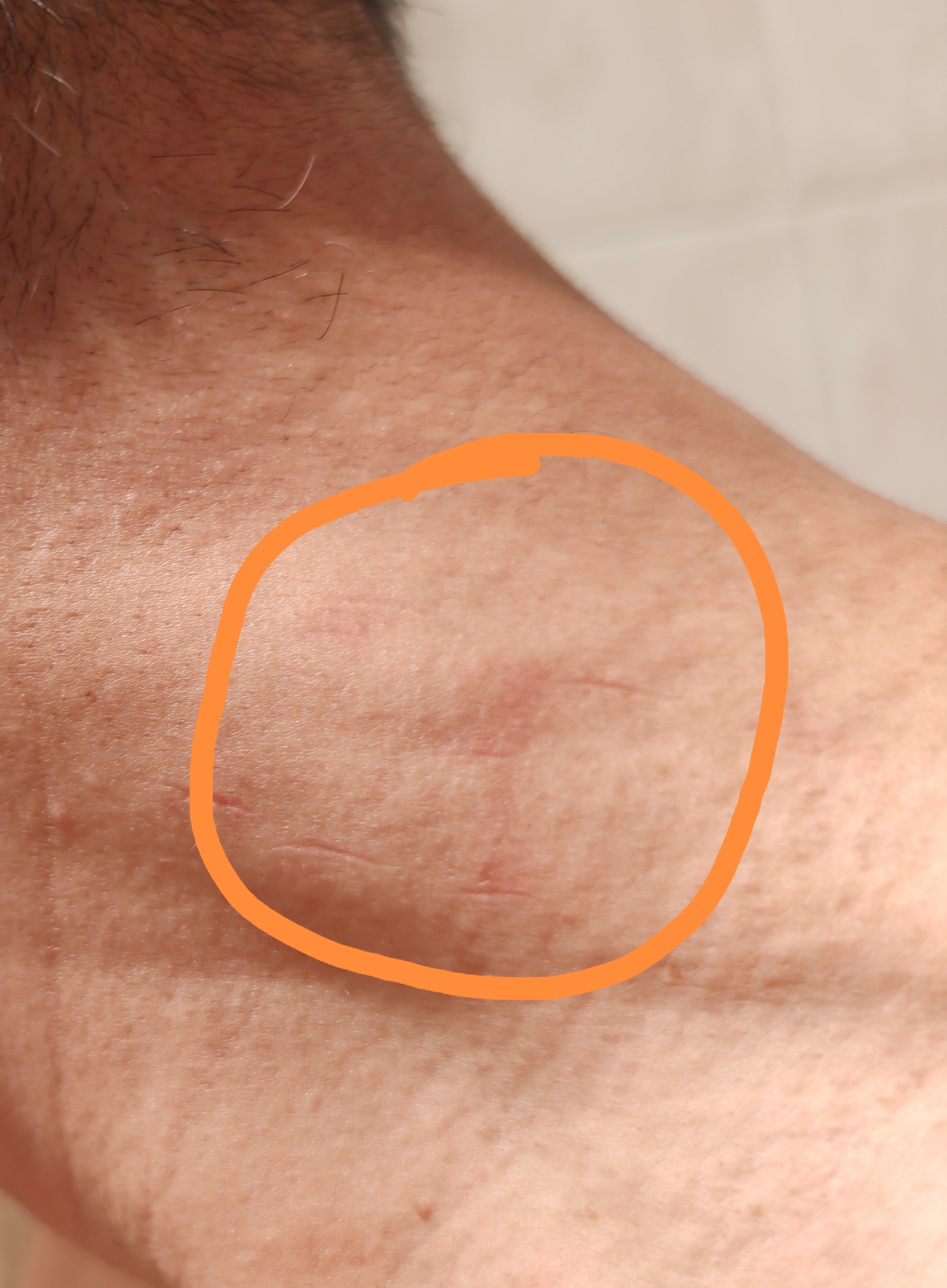 懂行的给初步看看. 准备去医院查查