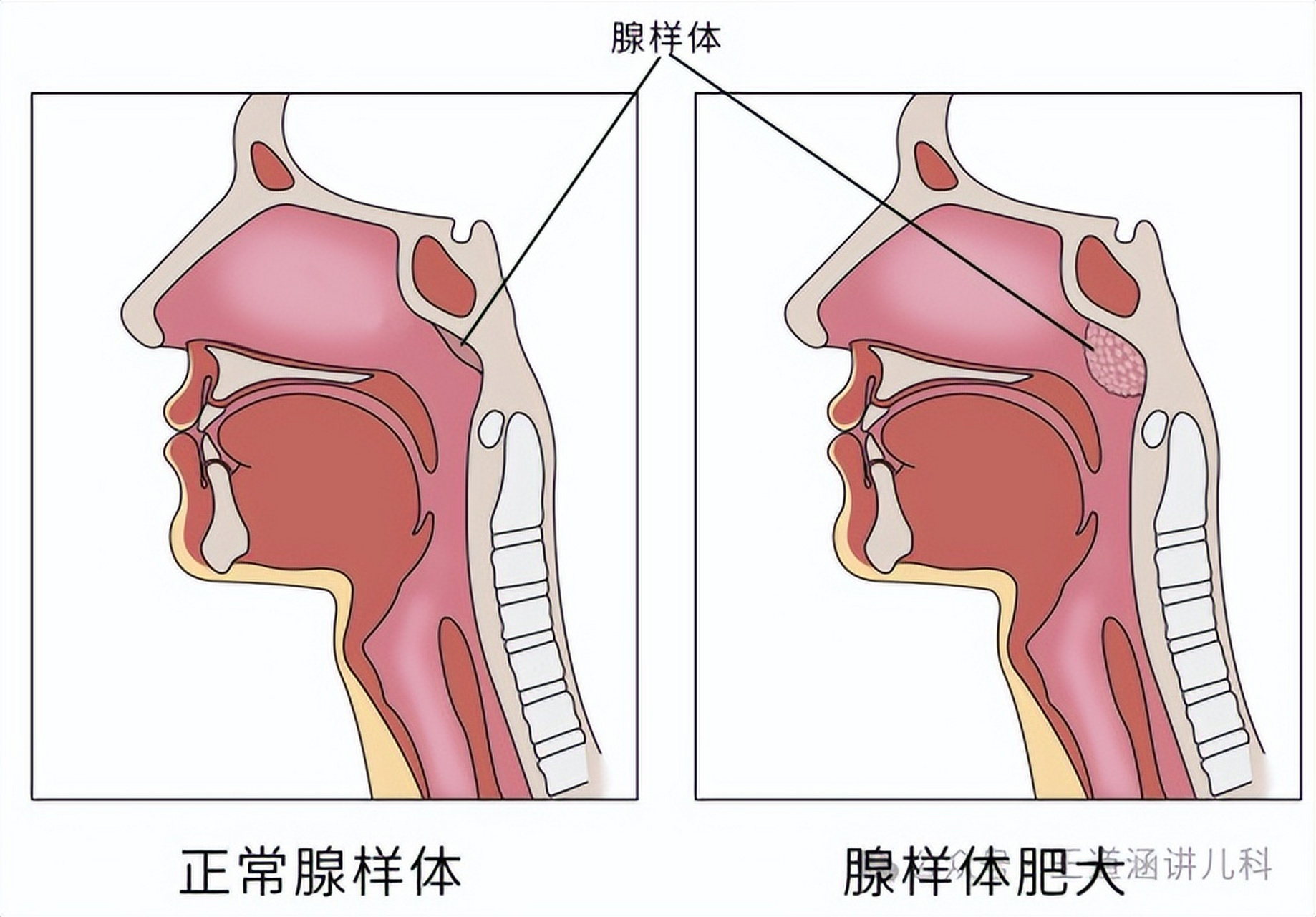 人体八大腺体准确位置图片