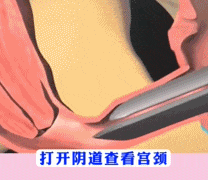 妇科鸭嘴钳被网暴,姐,你真不用把检查过程描述的这么具体