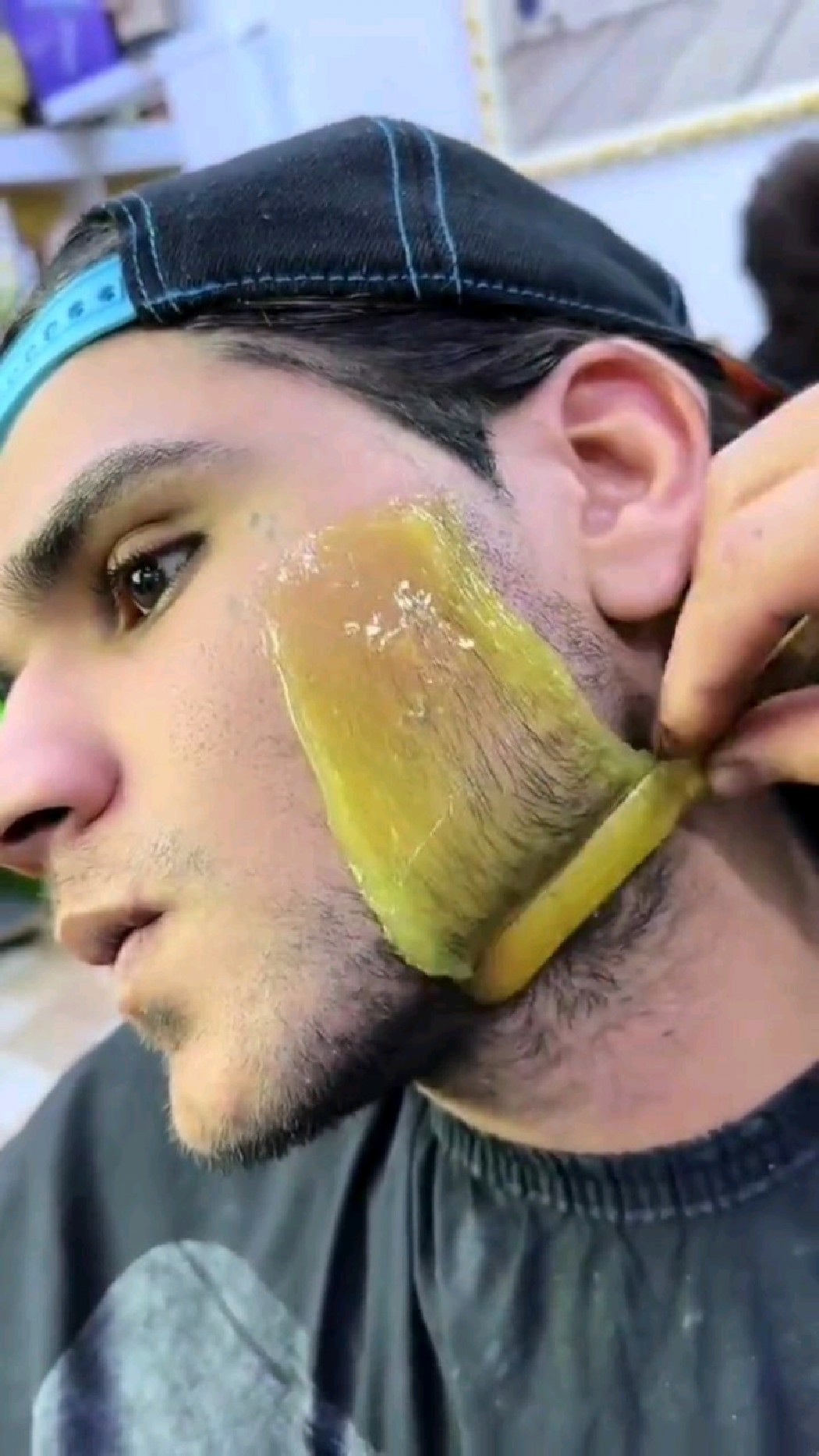 蜜蜡拔胡子,连根拔起,不留黑点