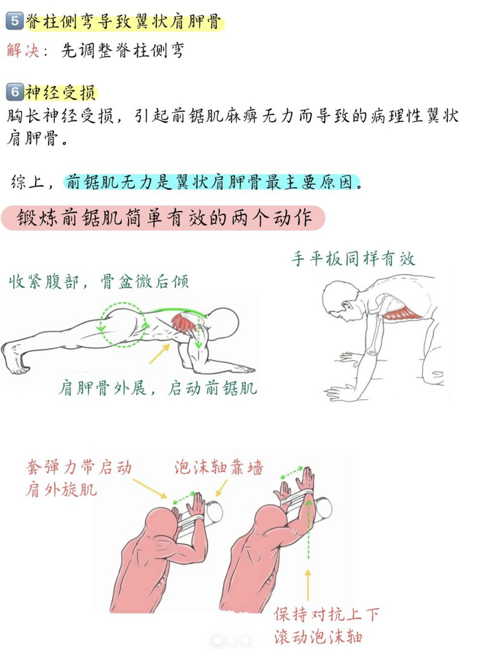 看这一篇就够了‼️ 翼状肩胛骨又被称为"天使之翼",肩胛骨内侧缘