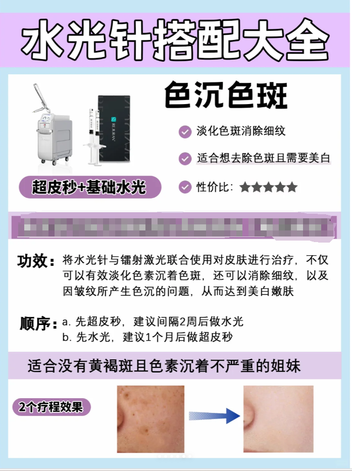 水光针的万能搭配 谁还不知道的60