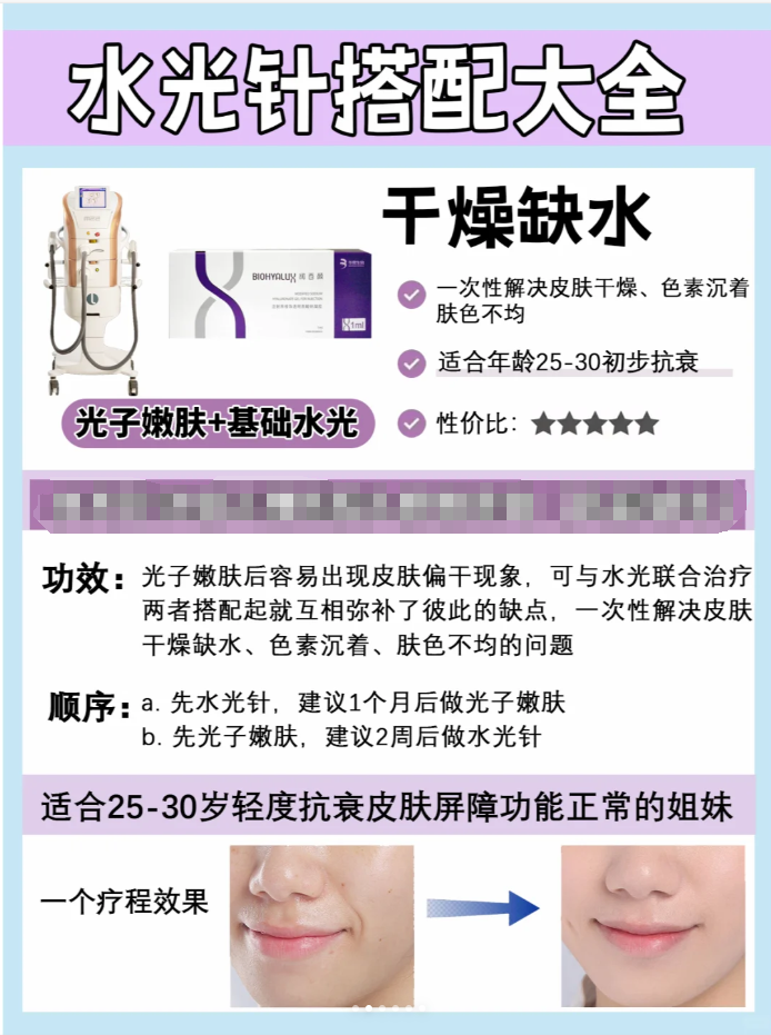 水光针的万能搭配 谁还不知道的60