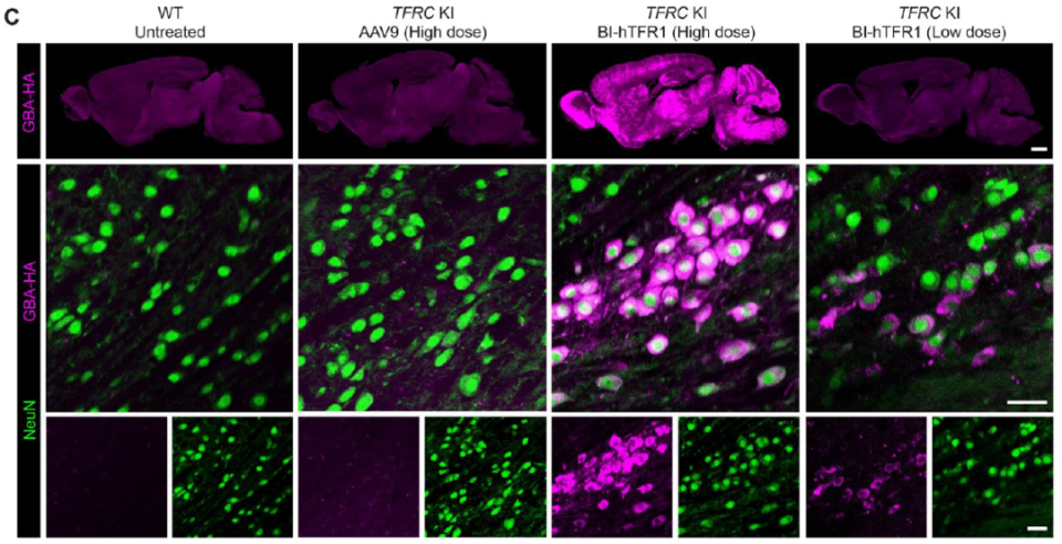 突破血脑屏障:新一代基因疗法为脑部疾病治疗带来希望