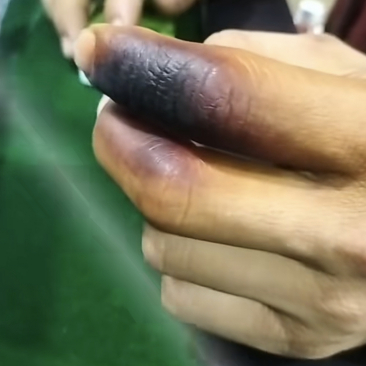 生命被烟熏黄的手指