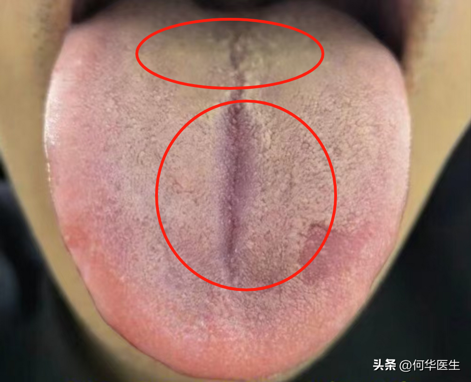 舌头变这样,你不生病谁生病,实话说,最怕的就是在门诊上遇见这样的