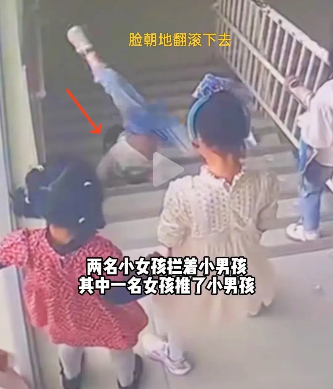 四川幼儿园男孩被霸凌推下楼梯,无辜的孩子,谁来保护他!