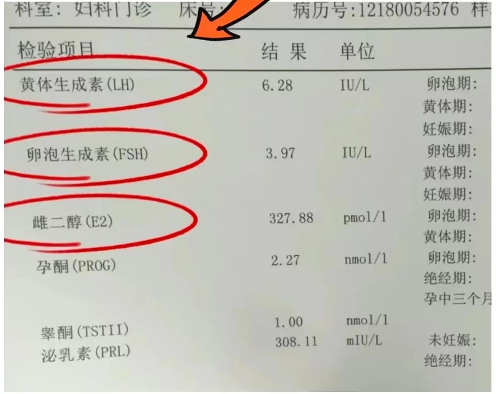 促排第五天fsh有多高_促排第五天lh值多少正常  第2张