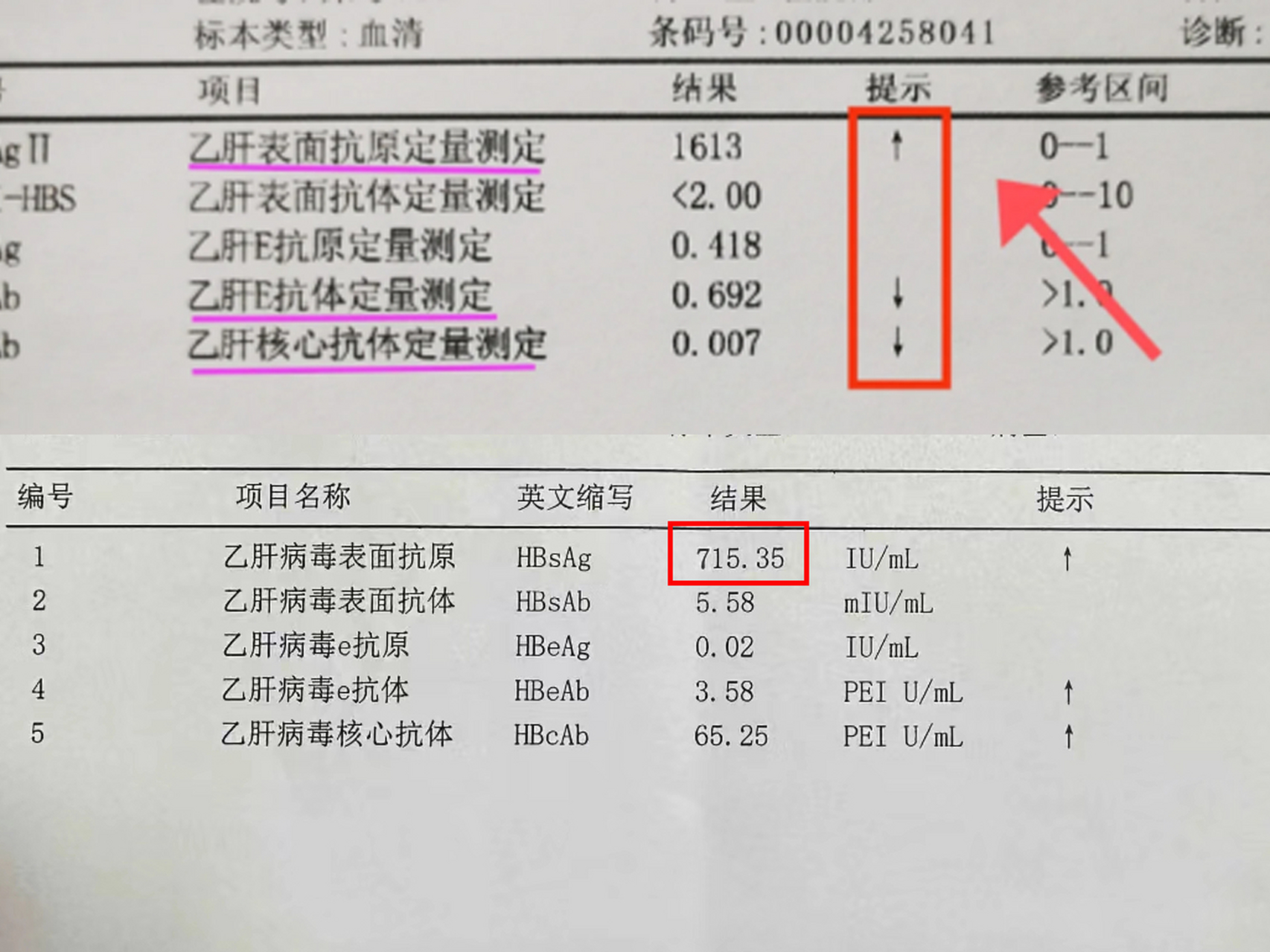 乙肝化验单图片