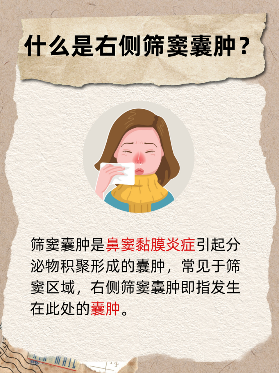 ⭕右侧筛窦囊肿是一种发生在鼻窦内的良性囊性病变,它通常是由于