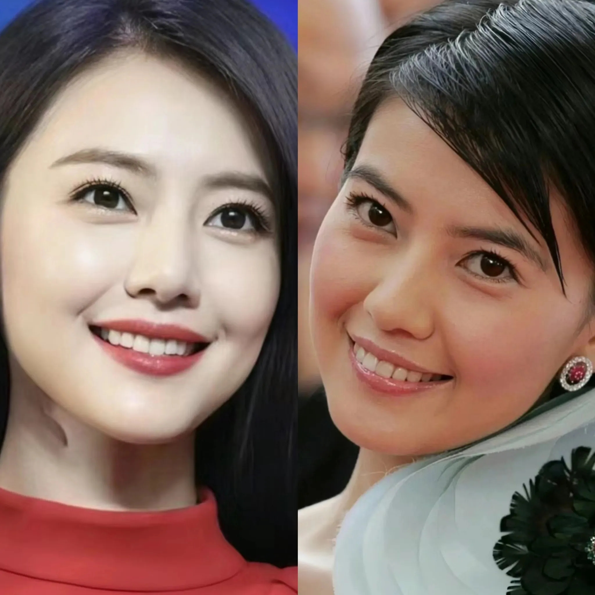 高圆圆的牙齿前后照片高圆圆整牙高圆圆整容高圆圆牙齿矫正前后对比照