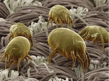 原来螨虫的"最大天敌"不是暴晒?1个"土方法",螨虫"就跑光了"