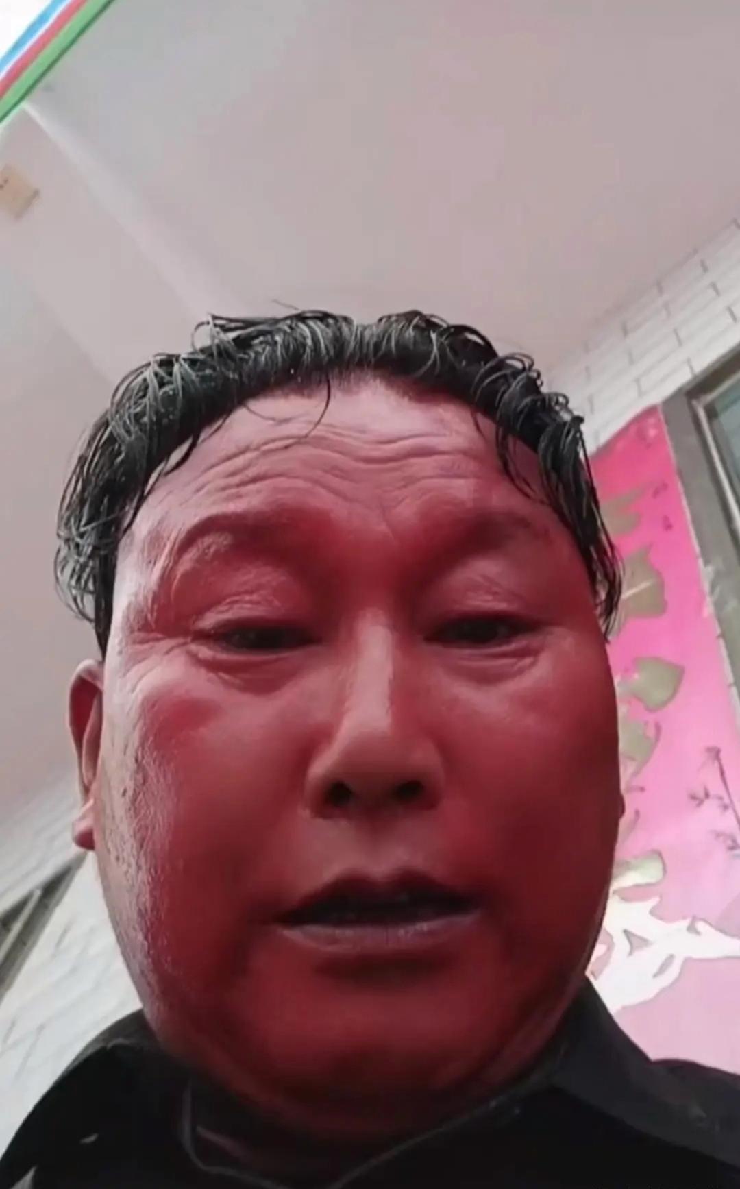 大家常看到喝酒脸红的人,但他这般红的着实罕见