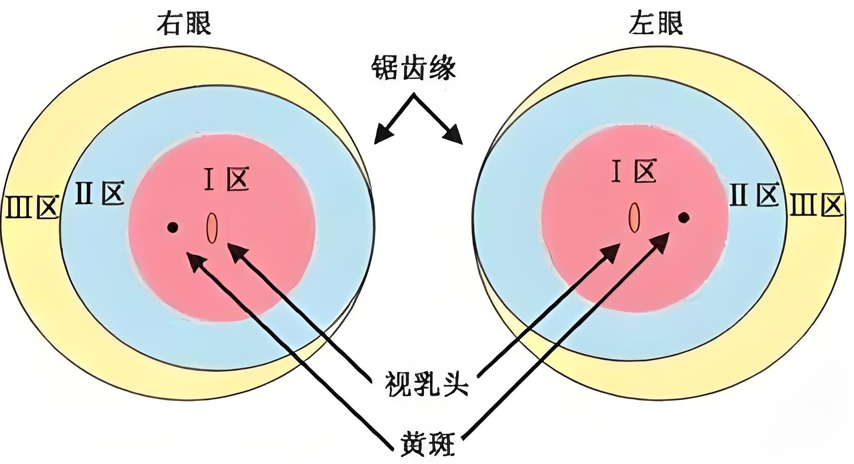 早产儿视网膜病变