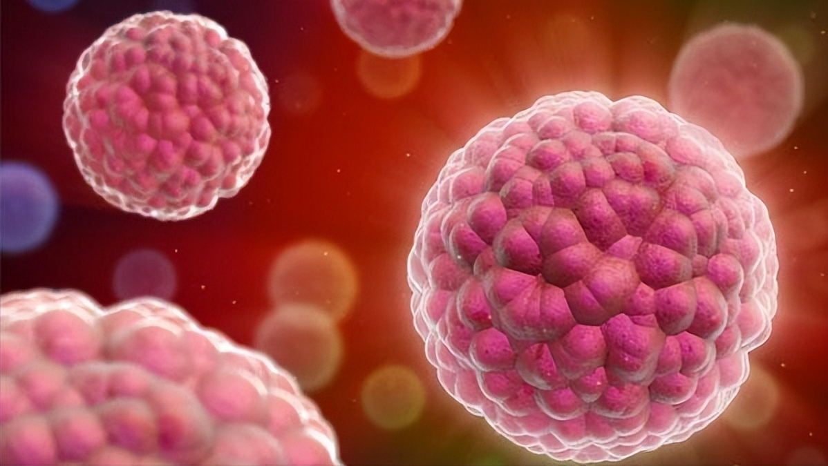 女子误诊脂肪瘤,确诊后1个月去世,医生无奈:发病率低的转移癌