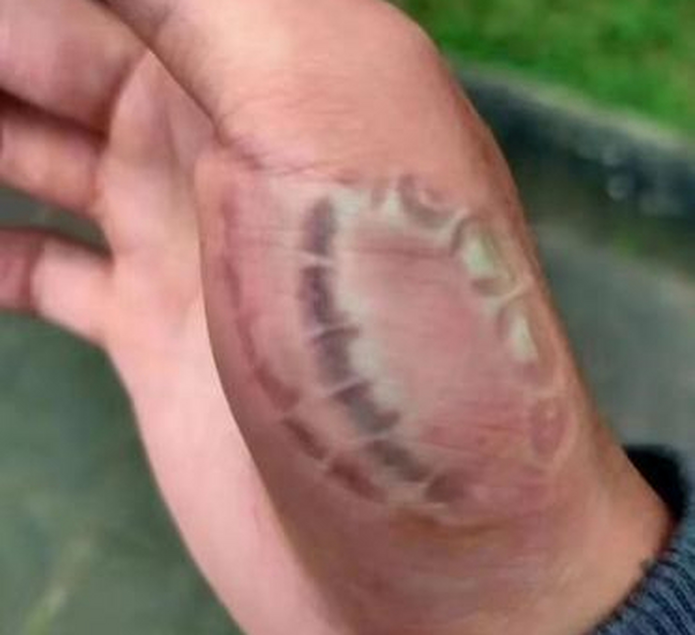 我那泼辣的老婆,刚刚不分轻重就里地咬了我一口,看着我手上深深的牙印