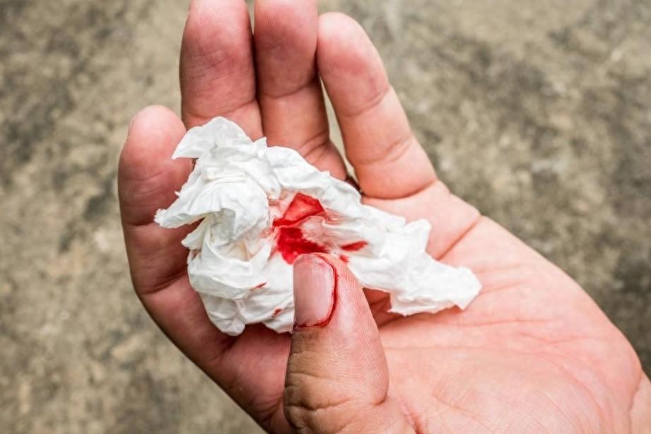 痔疮便血,你们觉得不管它最严重会怎么样?