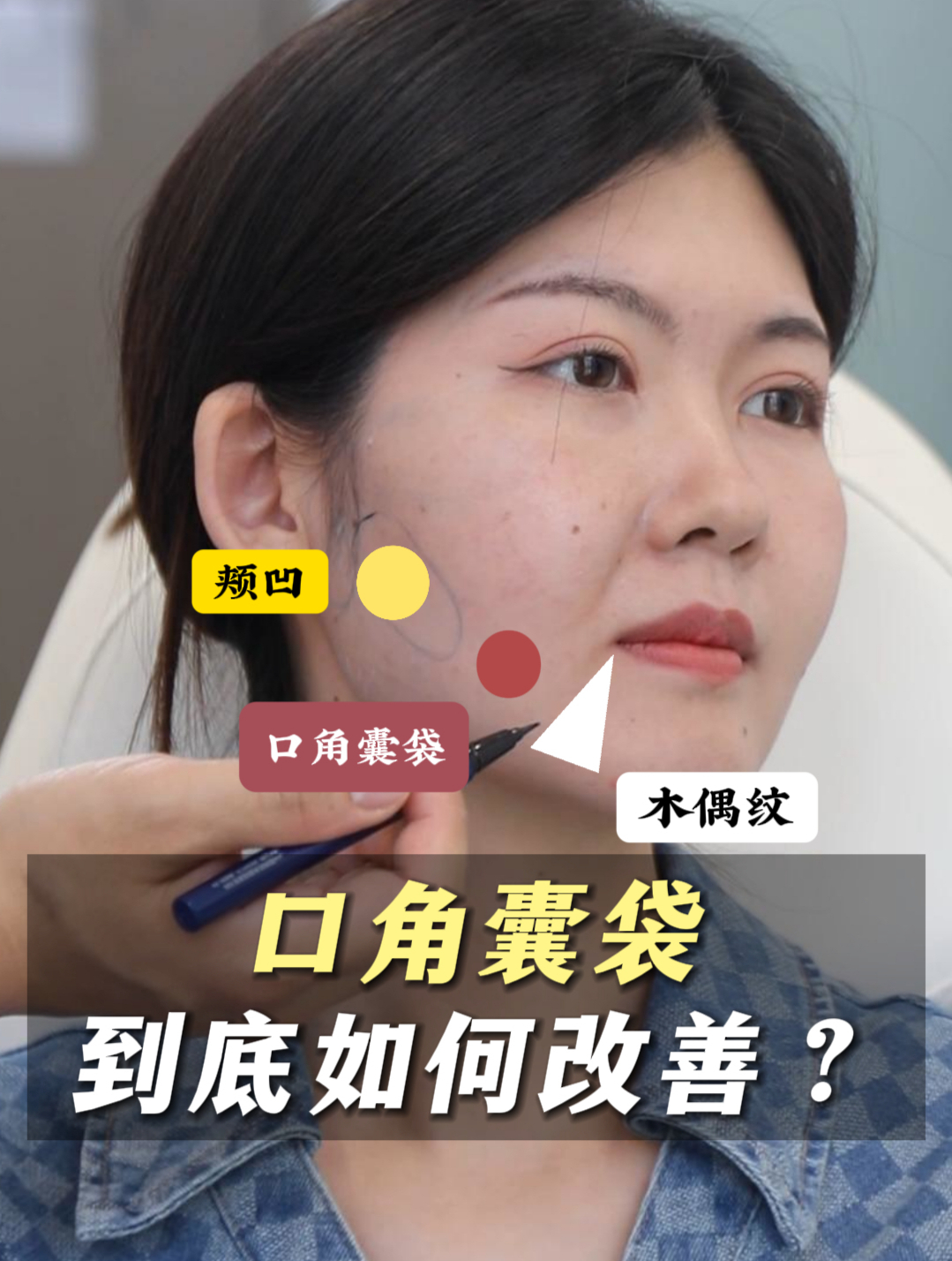 口角囊袋如何有效改善?关键点从哪里入手