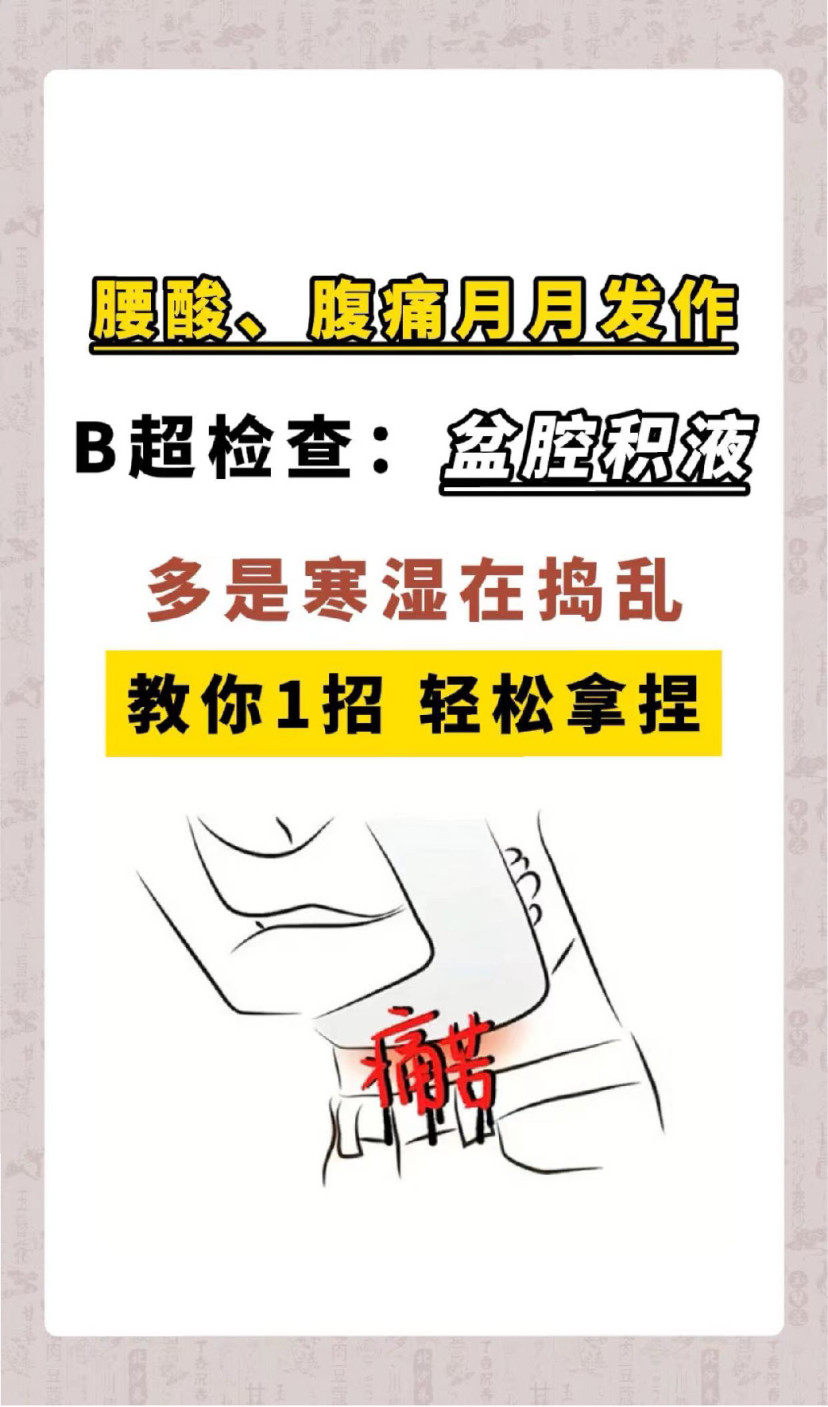 盆腔积液多是寒湿在捣乱,教你一招轻松拿捏!#盆腔积液