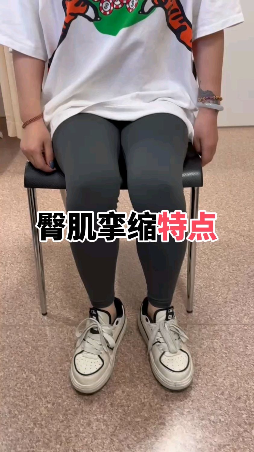 臀肌挛缩的特点,不能翘二郎腿,并腿下蹲有划圈征,走路外八