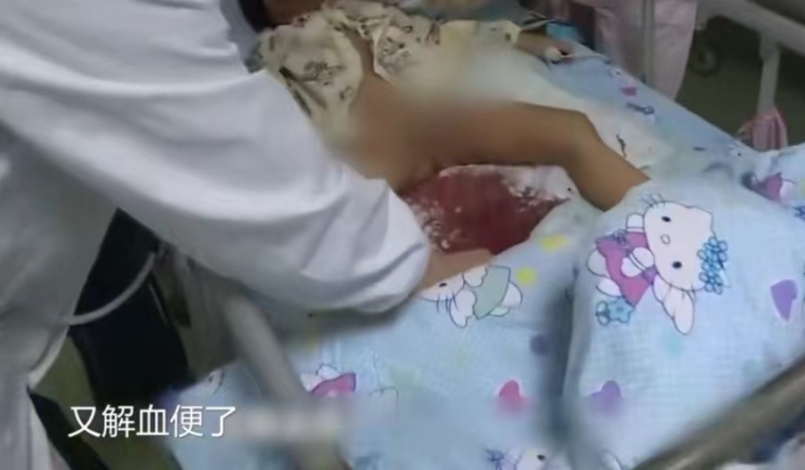 7岁娃吃3根冰棍后口吐鲜血,下体也流血不止,不得已被开腹检查