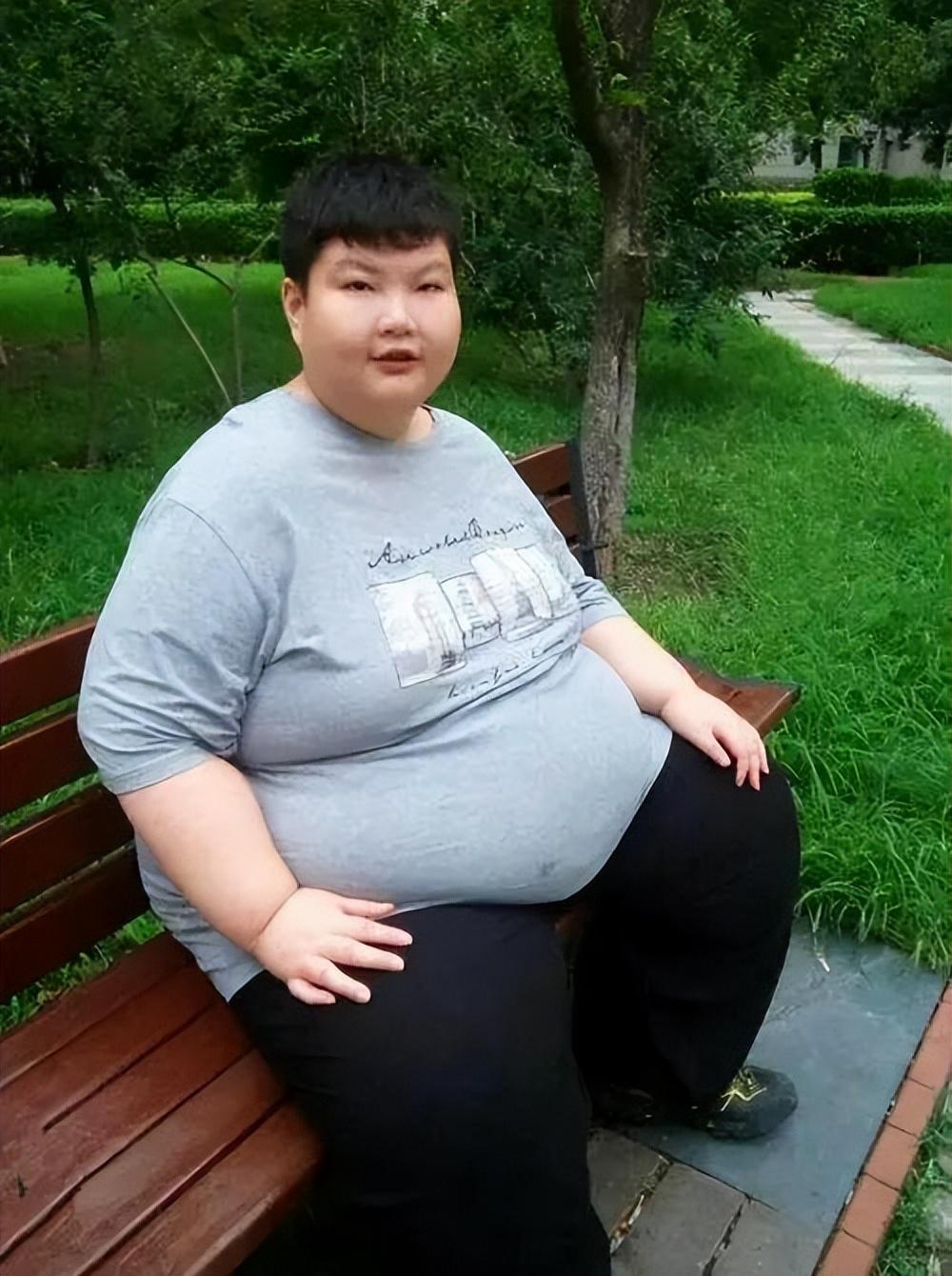 回顾:14岁男孩胖到300斤,一顿吃"18桶"泡面,离世前毛孔"流油"