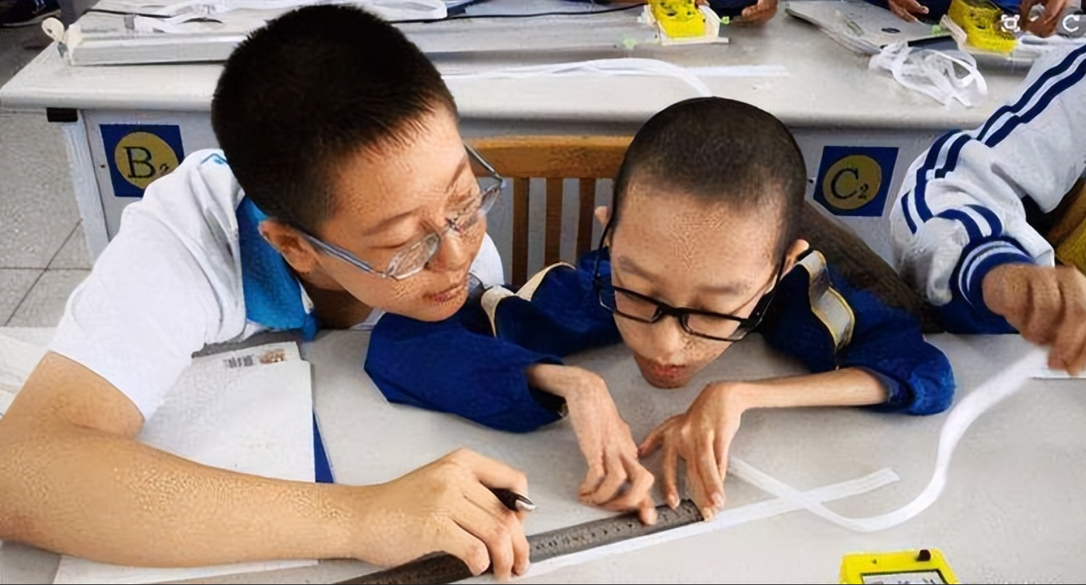 2021年,18公斤的渐冻症男孩645分考入北航,立志做中国"霍金"