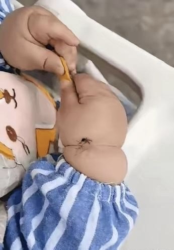 一挤,这该死的蚊子还没来得及饱食大餐便瞬间被挤成肉饼一命呜呼了!