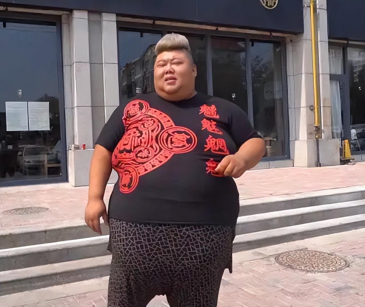 回顾:小伙从300多斤吃到560斤,家里常备三台呼吸机,月入几十万