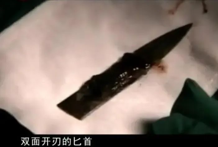 云南女子给丈夫按摩,导致丈夫吐血,检查发现头部有把10厘米匕首