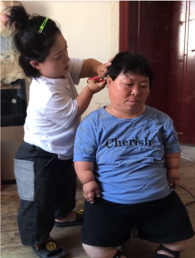 天生侏儒症,被生父嫌弃