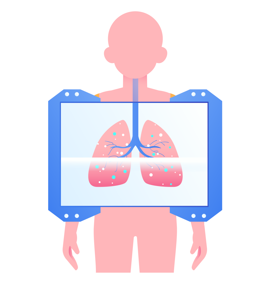 被"网住的肺"——特发性肺纤维化,治疗有哪些新进展?