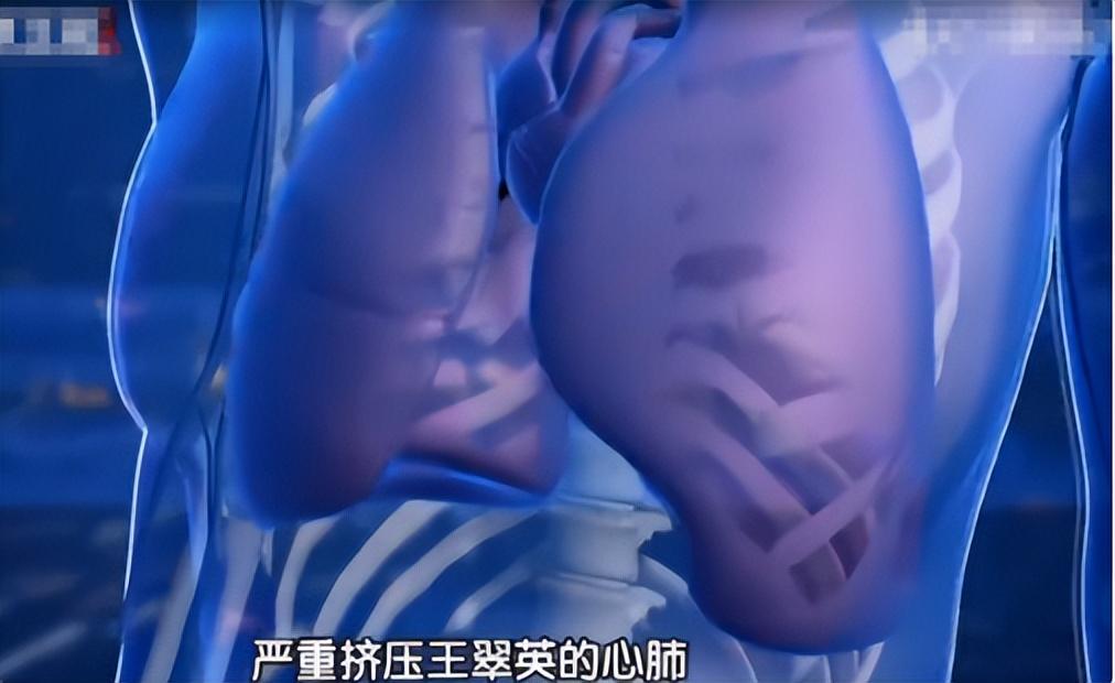 回顾中国首例5胞胎,20年后父亲因劳累过世,母亲直言后悔