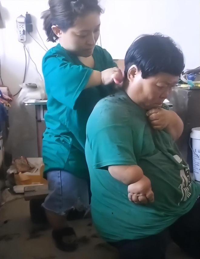 天生侏儒症,被生父嫌弃