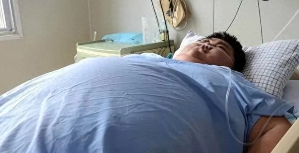 回顾超级小胖徐周磊:吃了18桶泡面死后浑身冒水,生前习惯很不好