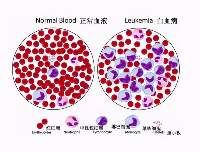 "白血病"为啥专挑孩子下手?医生说:3种水果,家长少给孩子吃
