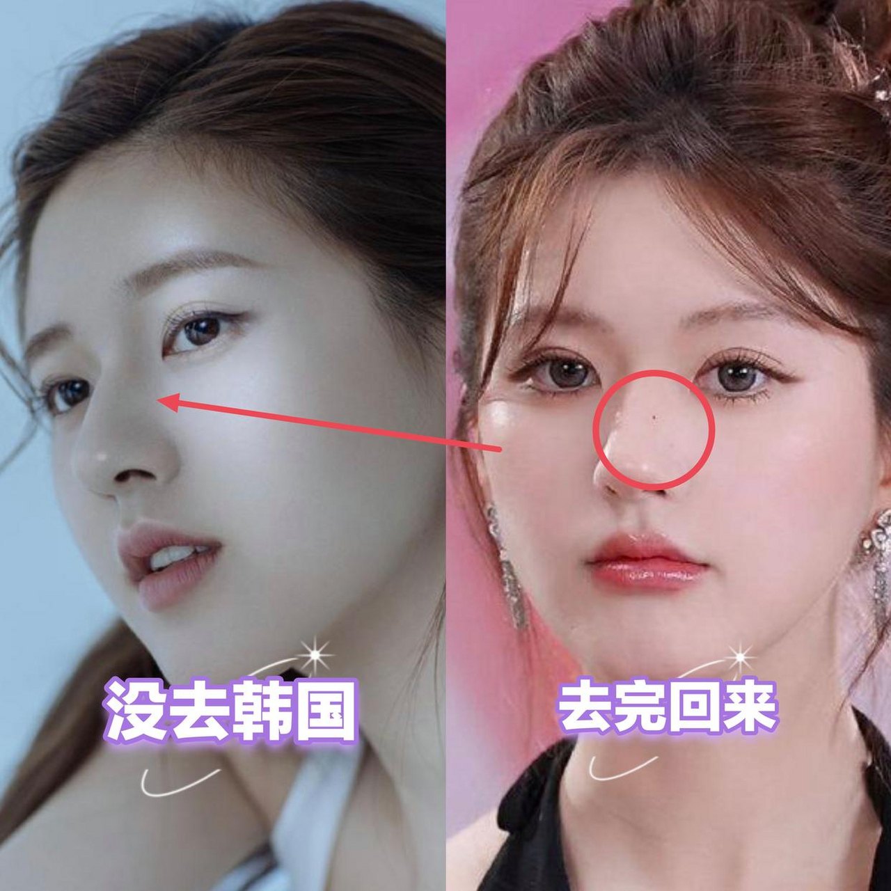 赵露思从韩国回来简直跟韩佳人一样,那鼻翼上的痣太迷人了