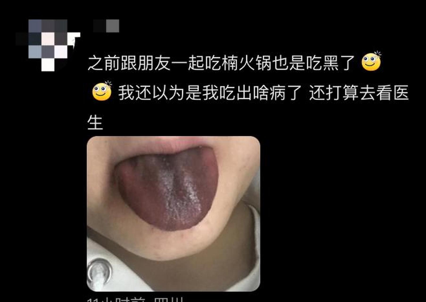 网红火锅店吃完舌头变黑 商家回应:可能是铁锅的原因 网友看到也晒了