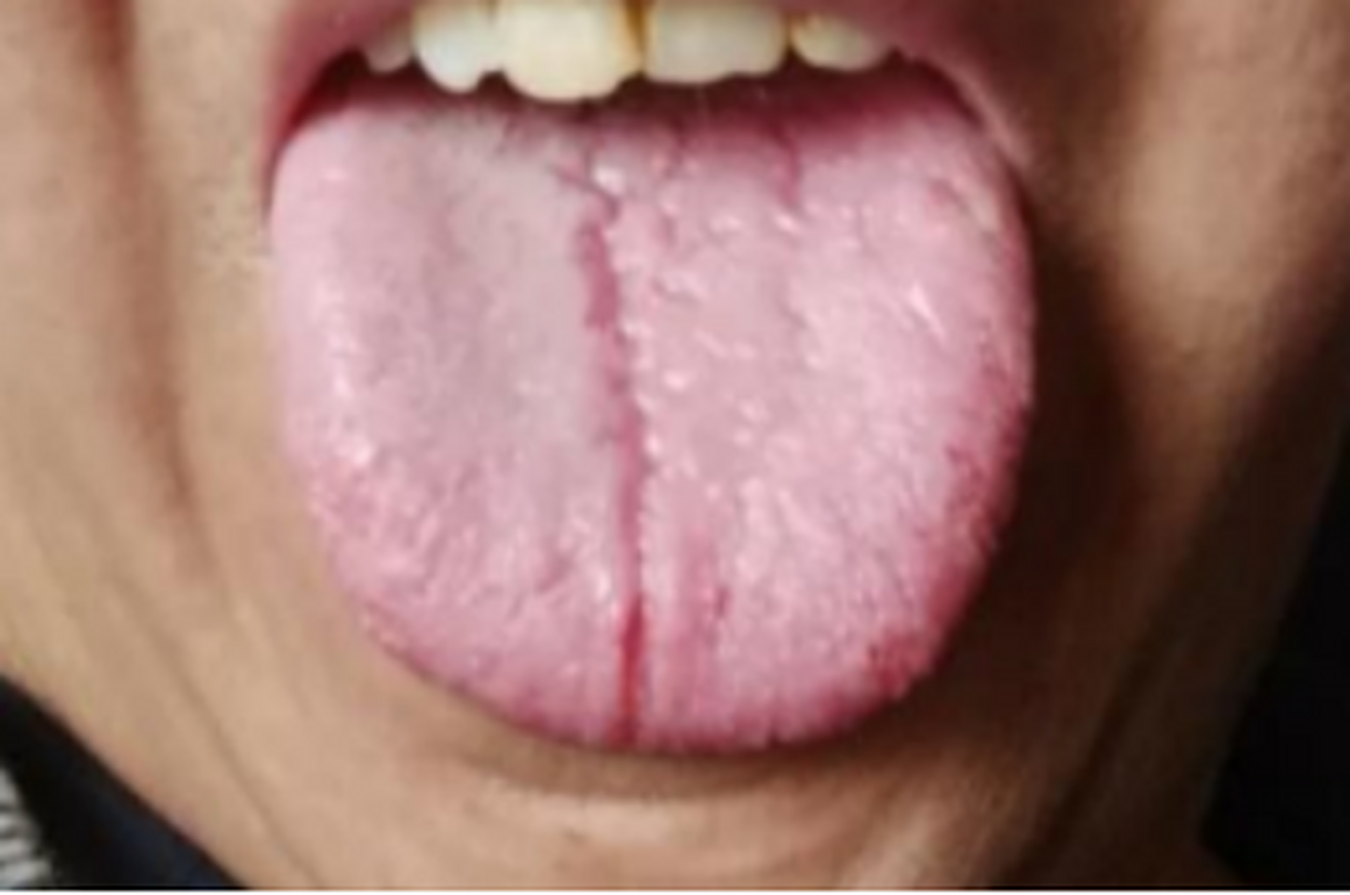 这舌头就像从中间裂开了一样,身上从头到脚都有问题!